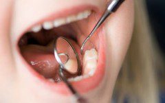 odontopediatria-natal