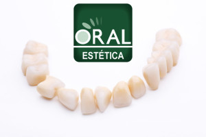 implantes dentários na Oral Estética